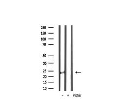 TIMP2 Polyclonal Antibody:Antibodies, Polyclonal