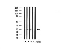 TIMP2 Polyclonal Antibody:Antibodies, Polyclonal