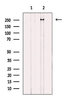 Invitrogen ARHGAP31 Polyclonal Antibody 100 &mu;L; Unconjugated:Antibodies,