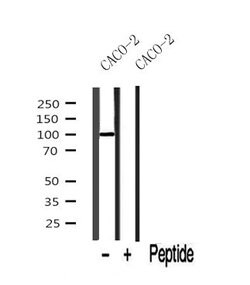 ROR1 Polyclonal Antibody:Antibodies, Polyclonal