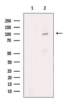 ROR1 Polyclonal Antibody:Antibodies, Polyclonal