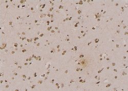Invitrogen Phospho-N-WASP (Tyr256) Polyclonal Antibody 100 &mu;L; Unconjugated:Antibodies,