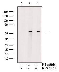 Invitrogen Phospho-N-WASP (Tyr256) Polyclonal Antibody 100 &mu;L; Unconjugated:Antibodies,