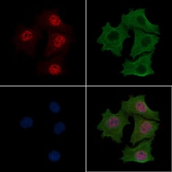Invitrogen Phospho-CDK20 (Thr161) Polyclonal Antibody 100 &mu;L; Unconjugated:Antibodies,