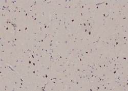 Invitrogen Phospho-CDK20 (Thr161) Polyclonal Antibody 100 &mu;L; Unconjugated:Antibodies,