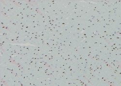Invitrogen Phospho-CDK20 (Thr161) Polyclonal Antibody 100 &mu;L; Unconjugated:Antibodies,