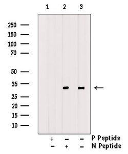 Invitrogen Phospho-CDK20 (Thr161) Polyclonal Antibody 100 &mu;L; Unconjugated:Antibodies,