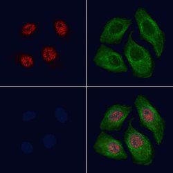 Invitrogen Phospho-SKI (Ser383) Polyclonal Antibody 100 &mu;L; Unconjugated:Antibodies,
