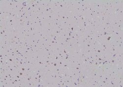 Invitrogen Phospho-SKI (Ser383) Polyclonal Antibody 100 &mu;L; Unconjugated:Antibodies,