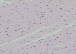 Invitrogen Phospho-SKI (Ser383) Polyclonal Antibody 100 &mu;L; Unconjugated:Antibodies,