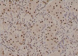 Invitrogen Phospho-CTGF (Ser118) Polyclonal Antibody 100 μL; Unconjugated:Antibodies,