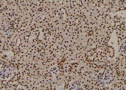 Invitrogen Phospho-CTGF (Ser118) Polyclonal Antibody 100 μL; Unconjugated:Antibodies,