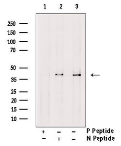 Invitrogen Phospho-CTGF (Ser118) Polyclonal Antibody 100 μL; Unconjugated:Antibodies,