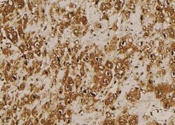 Invitrogen Phospho-KISS1R (Ser368) Polyclonal Antibody 100 &mu;L | Buy Online | Invitrogen&trade; | Fisher Scientific
