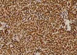Invitrogen Phospho-KISS1R (Ser368) Polyclonal Antibody 100 &mu;L | Buy Online | Invitrogen&trade; | Fisher Scientific