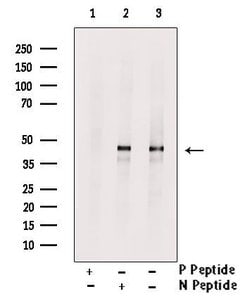 Invitrogen Phospho-KISS1R (Ser368) Polyclonal Antibody 100 &mu;L | Buy Online | Invitrogen&trade; | Fisher Scientific