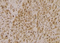 Invitrogen Phospho-HCN1 (Ser846) Polyclonal Antibody 100 &mu;L | Buy Online | Invitrogen&trade; | Fisher Scientific