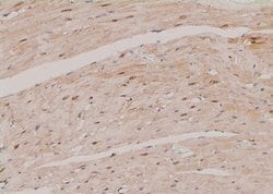 Invitrogen Phospho-HCN1 (Ser846) Polyclonal Antibody 100 &mu;L | Buy Online | Invitrogen&trade; | Fisher Scientific