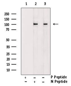 Invitrogen Phospho-HCN1 (Ser846) Polyclonal Antibody 100 &mu;L | Buy Online | Invitrogen&trade; | Fisher Scientific