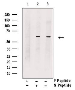 Phospho-KV1.1 (KCNA1) (Ser446) Polyclonal Antibody 100 &mu;L | Buy Online | Invitrogen | Fisher Scientific