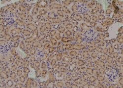 Invitrogen Phospho-MCT1 (Ser213) Polyclonal Antibody 100 &mu;L | Buy Online | Invitrogen&trade; | Fisher Scientific