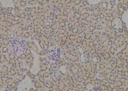 Invitrogen Phospho-MCT1 (Ser213) Polyclonal Antibody 100 &mu;L | Buy Online | Invitrogen&trade; | Fisher Scientific