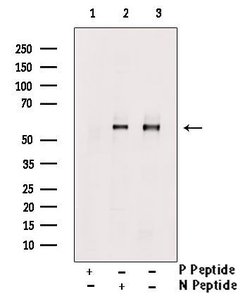 Invitrogen Phospho-MCT1 (Ser213) Polyclonal Antibody 100 &mu;L | Buy Online | Invitrogen&trade; | Fisher Scientific