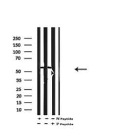 Invitrogen Phospho-MCT1 (Ser213) Polyclonal Antibody 100 &mu;L | Buy Online | Invitrogen&trade; | Fisher Scientific