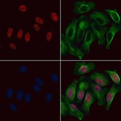 Invitrogen Phospho-HNF1A (Ser247) Polyclonal Antibody 100 &mu;L; Unconjugated:Antibodies,