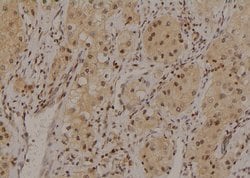 Invitrogen Phospho-HNF1A (Ser247) Polyclonal Antibody 100 &mu;L; Unconjugated:Antibodies,