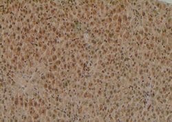 Invitrogen Phospho-HNF1A (Ser247) Polyclonal Antibody 100 &mu;L; Unconjugated:Antibodies,