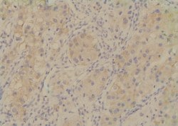 Invitrogen Phospho-TRAF7 (Ser61) Polyclonal Antibody 100 &mu;L | Buy Online | Invitrogen&trade; | Fisher Scientific