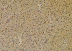 Invitrogen Phospho-SGLT1 (Ser335) Polyclonal Antibody 100 μL; Unconjugated:Antibodies,