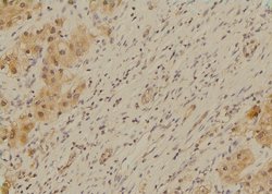 Invitrogen Phospho-SETD2 (Ser532) Polyclonal Antibody 100 &mu;L; Unconjugated:Antibodies,