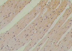 Invitrogen Phospho-SETD2 (Ser532) Polyclonal Antibody 100 &mu;L; Unconjugated:Antibodies,