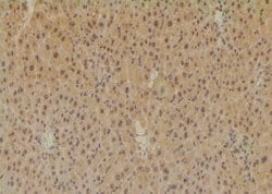 Invitrogen Phospho-SETD2 (Ser532) Polyclonal Antibody 100 &mu;L; Unconjugated:Antibodies,