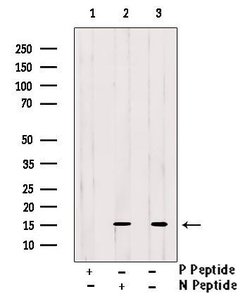 Invitrogen Phospho-FABP1 (Ser11) Polyclonal Antibody 100 μL; Unconjugated:Antibodies,