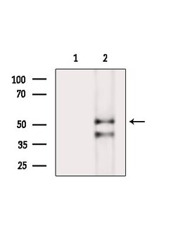 Phospho-NEK2 (Ser171) Polyclonal Antibody:Antibodies, Polyclonal