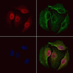 Phospho-NEK2 (Ser171) Polyclonal Antibody:Antibodies, Polyclonal