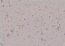 Phospho-NEK2 (Ser171) Polyclonal Antibody:Antibodies, Polyclonal