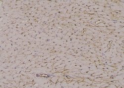 Phospho-NEK2 (Ser171) Polyclonal Antibody:Antibodies, Polyclonal