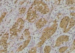 Invitrogen Phospho-ADAM9 (Thr761) Polyclonal Antibody 100 &mu;L; Unconjugated:Antibodies,
