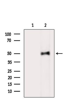 Invitrogen Phospho-FKBP4 (Tyr220) Polyclonal Antibody 100 &mu;L | Buy Online | Invitrogen&trade; | Fisher Scientific