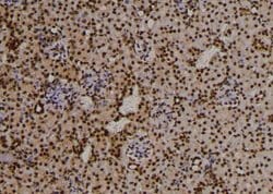 Invitrogen Phospho-FKBP4 (Tyr220) Polyclonal Antibody 100 &mu;L | Buy Online | Invitrogen&trade; | Fisher Scientific