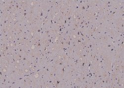 Phospho-FMRP (Ser500) Polyclonal Antibody:Antibodies, Polyclonal