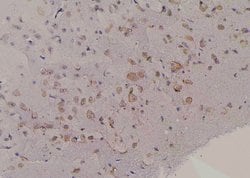 Phospho-FMRP (Ser500) Polyclonal Antibody:Antibodies, Polyclonal