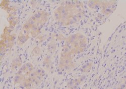 Invitrogen Phospho-HPRT1 (Ser110) Polyclonal Antibody 100 &mu;L; Unconjugated:Antibodies,