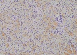 Invitrogen Phospho-HPRT1 (Ser110) Polyclonal Antibody 100 &mu;L; Unconjugated:Antibodies,