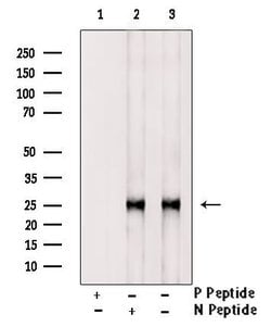 Invitrogen Phospho-HPRT1 (Ser110) Polyclonal Antibody 100 &mu;L; Unconjugated:Antibodies,