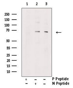 Invitrogen Phospho-PINK1 (Ser228) Polyclonal Antibody 100 &mu;L | Buy Online | Invitrogen&trade; | Fisher Scientific